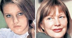 Настя Заворотнюк теряет лицо
